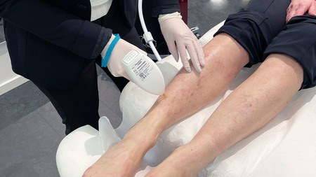 Behandler og kunde, laserbehandling på ben